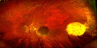 FONDAZIONE ITALIANA MACULA ENTE DEL TERZO SETTORE
